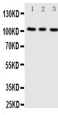 ADAMTS1 Antibody (aa956-968)