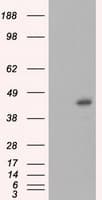 Monoclonal Mouse anti-Human MCL1 / MCL 1 Antibody (clone OTI4B7, IHC, IF, WB)