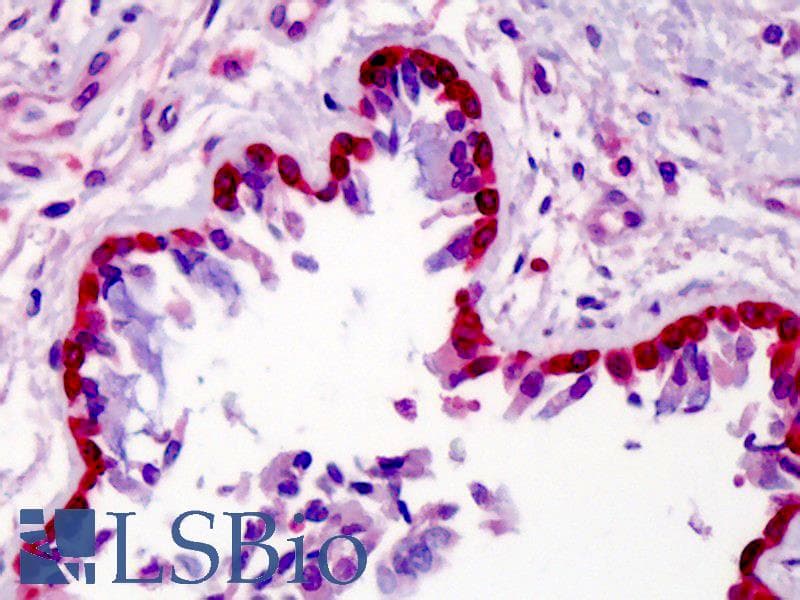 IHC-plus™ Polyclonal Rabbit anti-Human METTL7A Antibody (IHC, IF, WB)