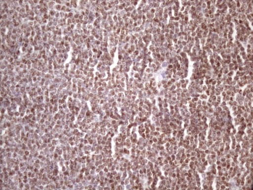 IKBKE / IKKI / IKKE Antibody (aa474-716, clone OTI3C5)