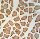 TECR / TER Antibody (aa268-295)