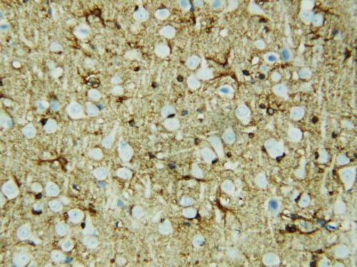 HSF2 Antibody (aa82-102)