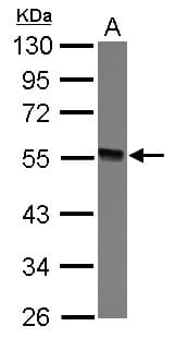 Polyclonal Rabbit anti-Human GTDC1 Antibody (WB)