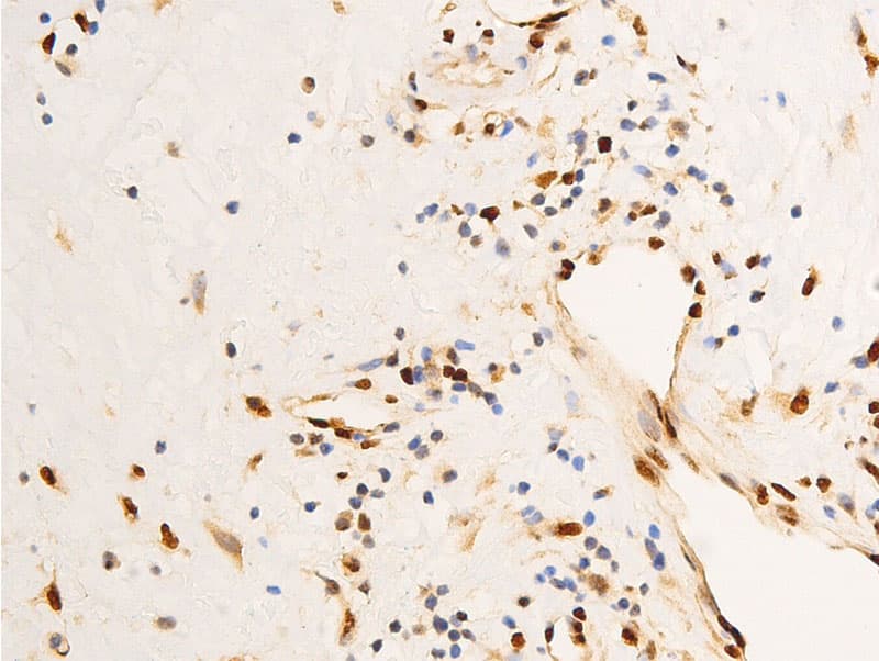JUN / c-Jun Antibody (phospho-Ser63)