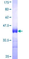 Human MARCKS Protein (Recombinant GST, N-terminus)