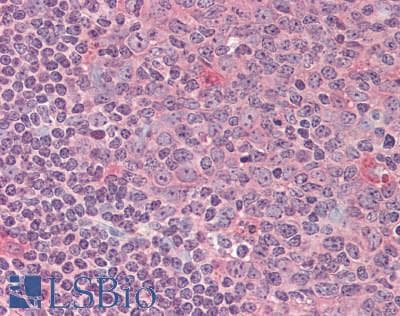IHC-plus™ Polyclonal Rabbit anti-Human NADK / NAD Kinase Antibody (IHC)