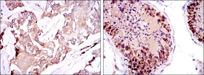 SMN1 Antibody (clone 5H1)