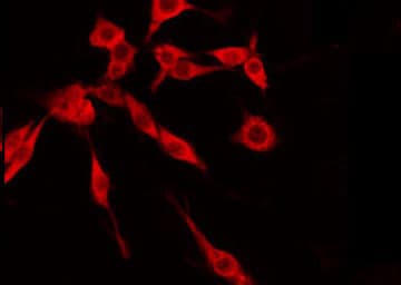 Polyclonal Rabbit anti-Human TMEM237 / ALS2CR4 Antibody (IF, WB)