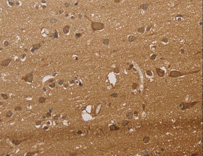 CSNK2B / Phosvitin Antibody