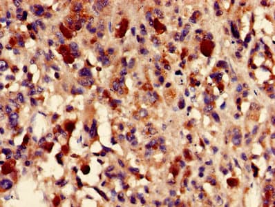 FH / Fumarase / MCL Antibody
