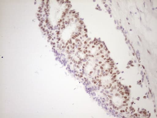 Monoclonal Mouse anti-Human TFPI / LACI Antibody (clone OTI5H5, Carrier-free, aa29-304, IHC, WB)