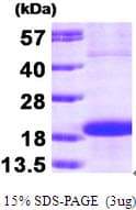 Human SKP1 Protein (Recombinant)