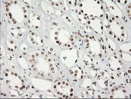ERCC1 Antibody (clone 2.00E+12, Carrier-free)