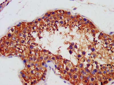 Polyclonal Rabbit anti-Human AIFM1 / AIF / PDCD8 Antibody (aa103-612)