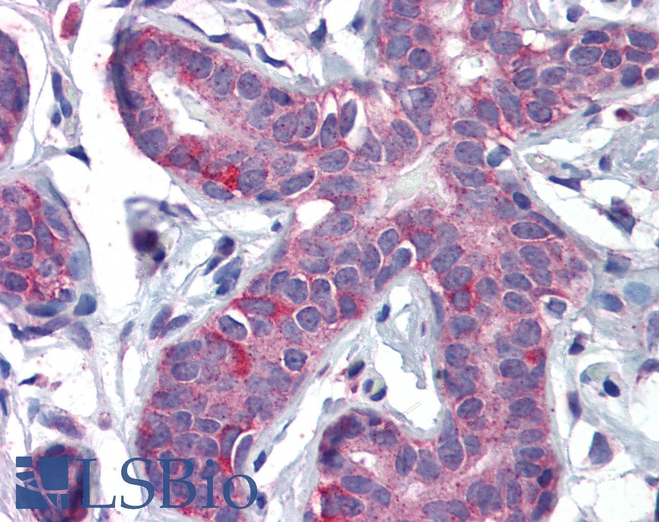 IHC-plus™ Polyclonal Goat anti-Human PPARD / PPAR Delta Antibody (aa430-441, IHC, WB)