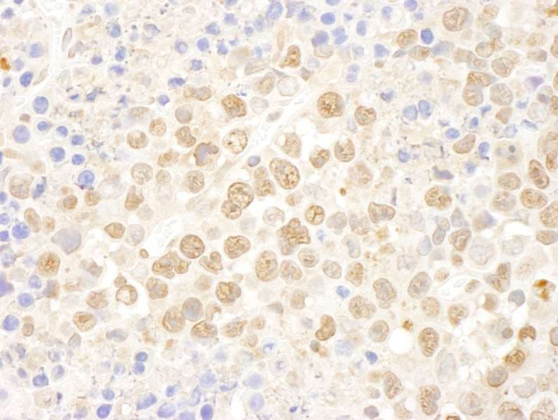 DDX27 Antibody (aa700-750)