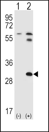 Polyclonal Rabbit anti-Human STAP1 / BRDG1 Antibody (aa41-70, IHC, WB)