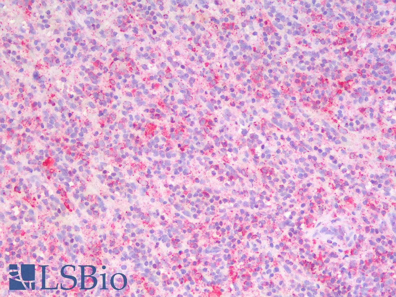 IHC-plus™ HSPA5 / GRP78 / BiP Antibody