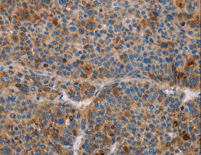 AMBP Antibody