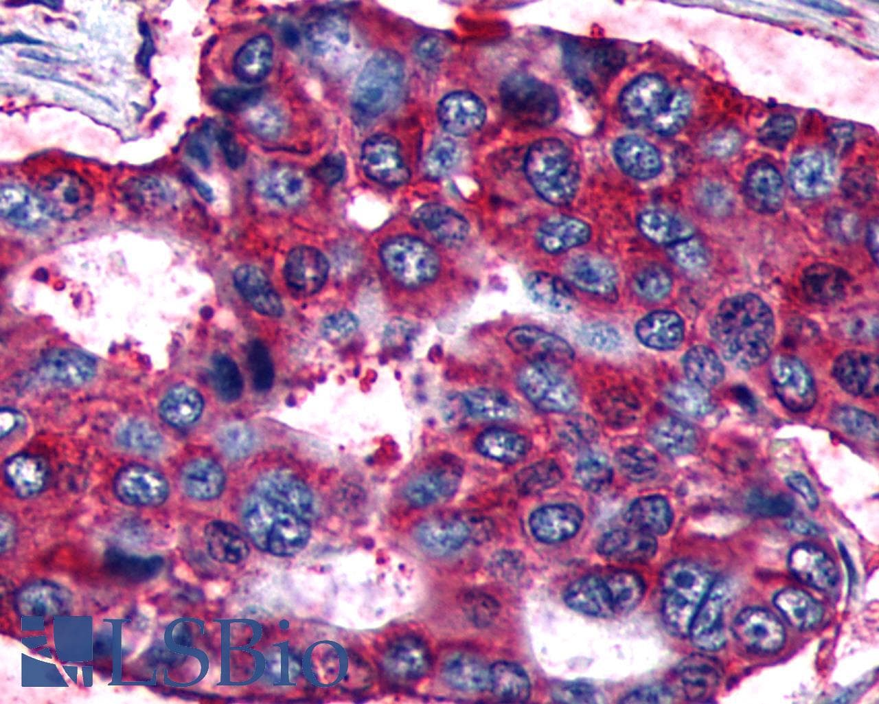PathPlus™ Polyclonal Rabbit anti-Human RXFP2 / LGR8 Antibody (Cytoplasmic Domain, IHC, WB)