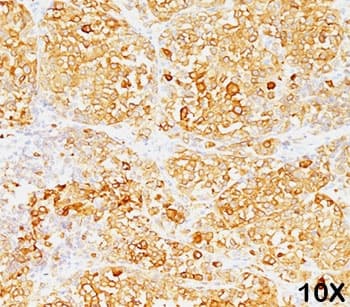 MLANA / Melan-A Antibody (clone M2-9E3, Azide-free, BSA-free)