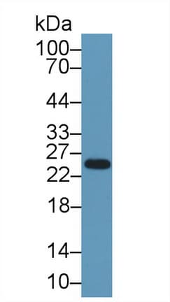 CELA1 / Pancreatic Elastase 1 Antibody (aa40-258)