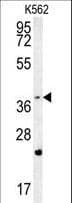 FBXW12 Antibody (aa291-320)