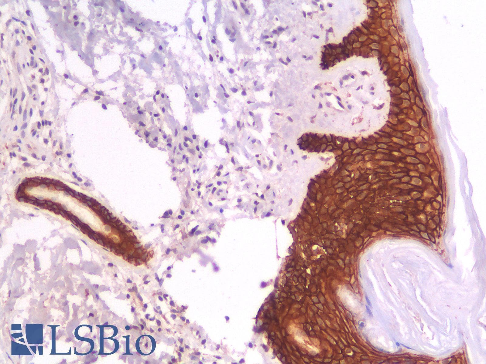 PathPlus™ Recombinant Monoclonal Mouse anti-Human CD44 Antibody (clone rCD44v9/1459, IHC)