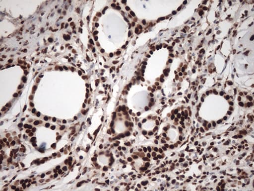 TRIM28 / KAP1 Antibody (clone OTI7A4)