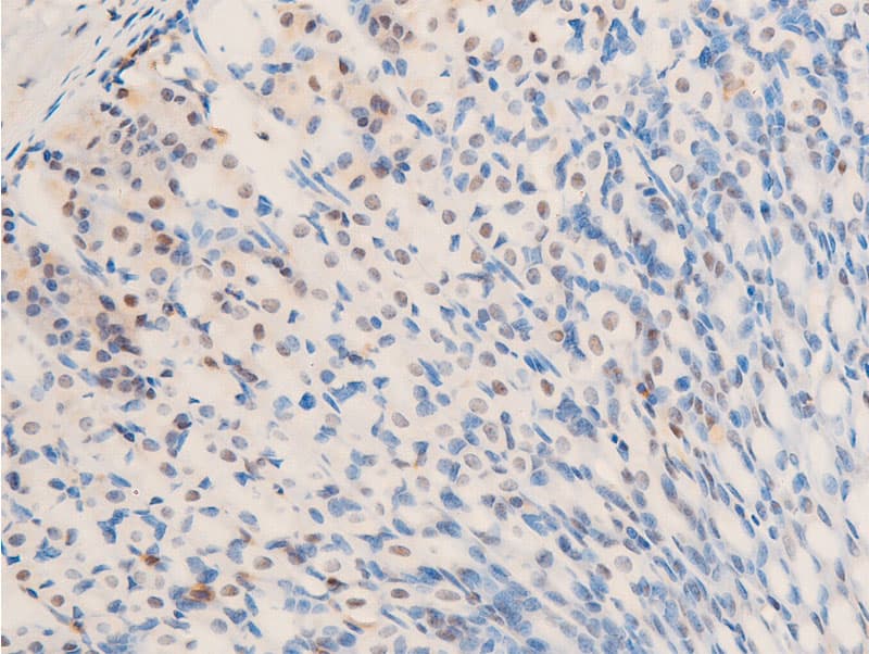 ERBB2 / HER2 Antibody (phospho-Tyr1248)