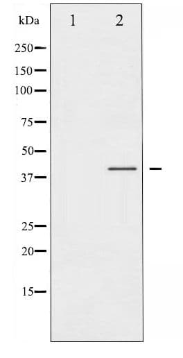 Polyclonal Rabbit anti-Human CCR5 Antibody (phospho-Ser336, WB)