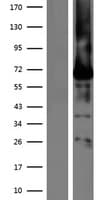 Human BEST1 / BEST / Bestrophin Protein (Over-Expression Lysate Myc-DDK (Flag))