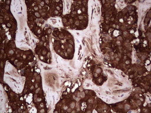 PKM2 Antibody (clone OTI12D5, Carrier-free)