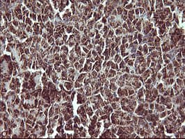 MMP13 Antibody (aa104-471, clone OTI2D8)