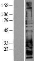 Human SELPLG / PSGL-1 / CD162 Protein (Over-Expression Lysate Myc-DDK (Flag))