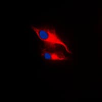 p56lck / LCK Antibody (phospho-Tyr393)