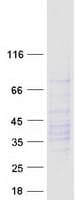 Human CXCR2 Protein (Recombinant Myc-DDK (Flag))