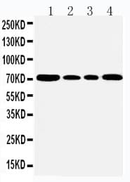 HSPA5 / GRP78 / BiP Antibody (aa603-617)
