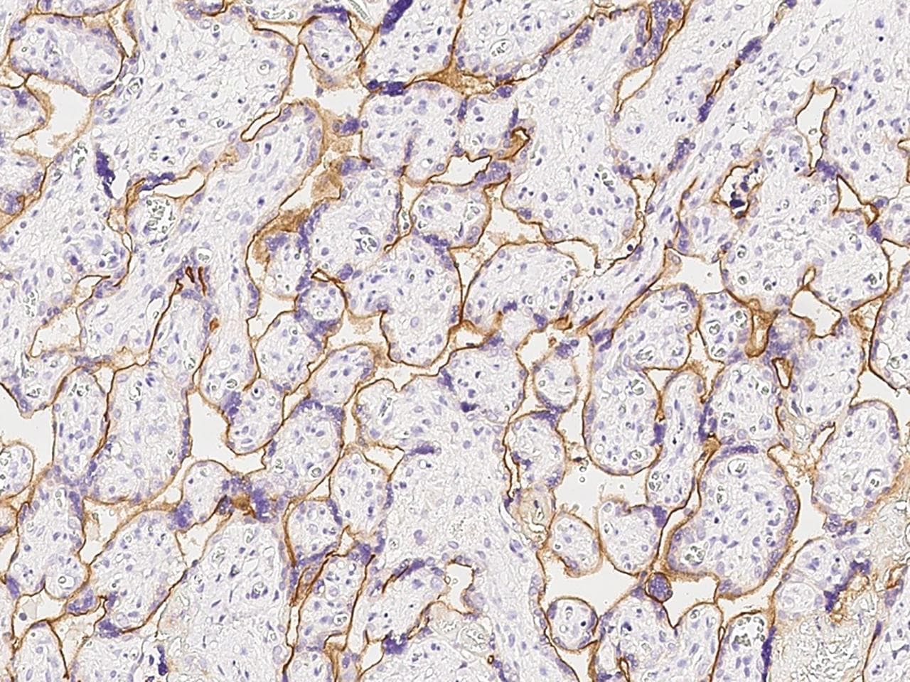 Monoclonal Mouse anti-Human INSR / Insulin Receptor Antibody (clone 07, Preservative Free, IHC)