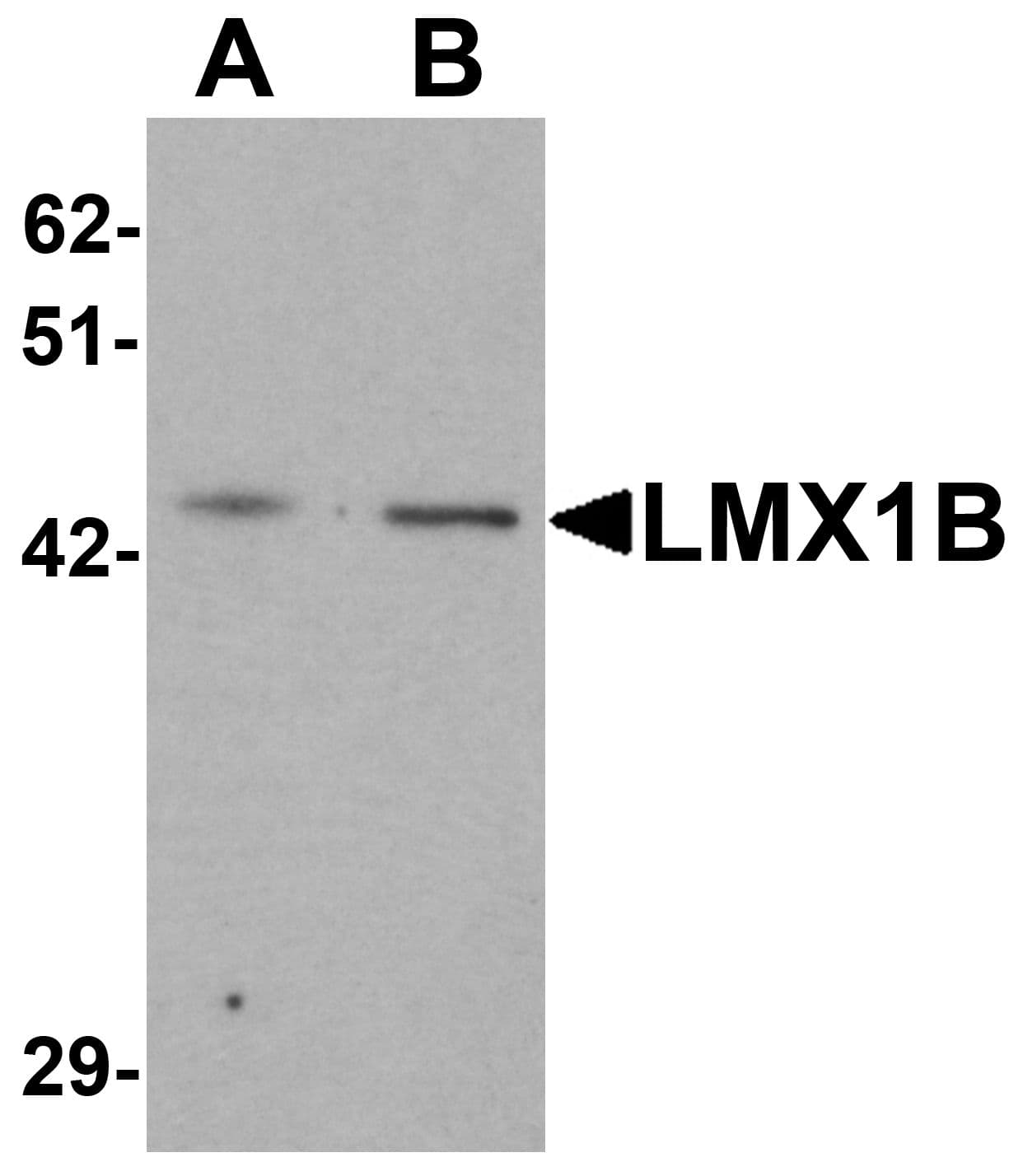 IHC-plus™ LMX1B Antibody