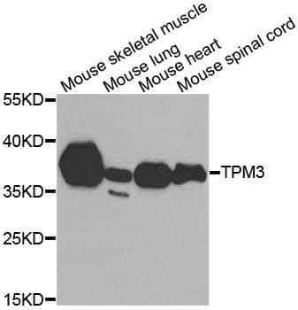 TPM3 Antibody