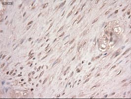Monoclonal Mouse anti-Human MYC / c-Myc Antibody (clone OTI1A6, IHC, IF, WB)