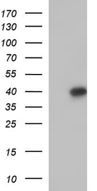 Apolipoprotein A-V Antibody (clone OTI1G4)