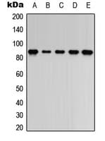 Polyclonal Rabbit anti-Human ARHGEF7 Antibody (Internal, IHC, WB)