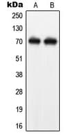 IHC-plus™ NF-L / NEFL Antibody (C-Terminus)