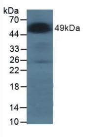 GLA / Alpha Galactosidase Antibody (aa81-429, APC)