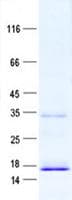 Human PTPMT1 Protein (Recombinant His, N-Terminal)