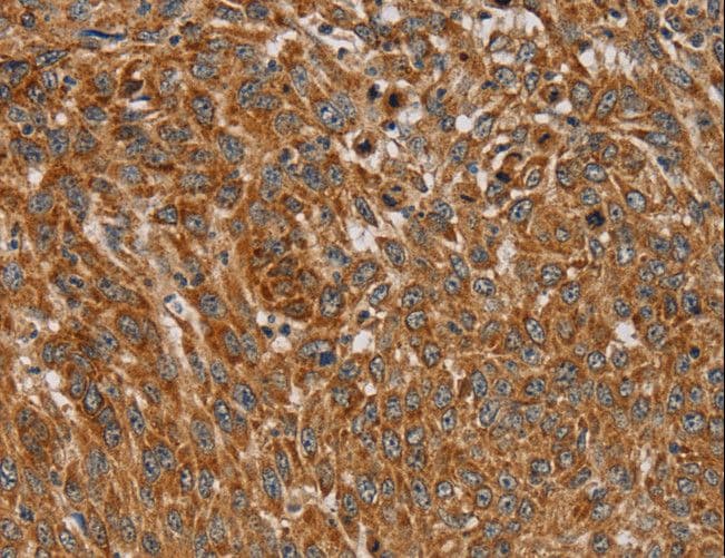 Polyclonal Rabbit anti-Human PLEKHG6 Antibody (IHC, WB)