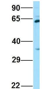 SPAM1 / PH20 Antibody (aa437-486, Biotin)