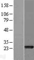 HsT19268 / MTHFS Protein (Over-Expression Lysate Myc-DDK (Flag))